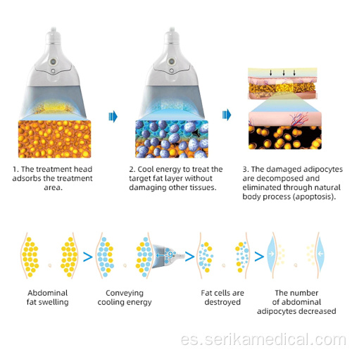 Máquina de congelación de la grasa de la criolipólisis del vacío portátil